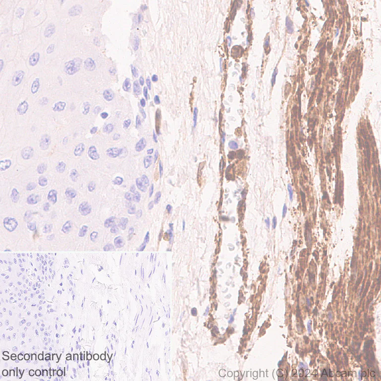 Immunohistochemistry (Formalin/PFA-fixed paraffin-embedded sections) - Anti-TAGLN/Transgelin antibody [EPR11995(B)] - BSA and Azide free (AB249579)