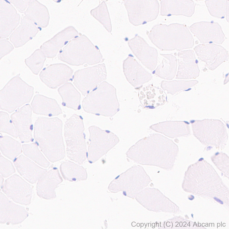 Immunohistochemistry (Formalin/PFA-fixed paraffin-embedded sections) - Anti-TAGLN/Transgelin antibody [EPR11995(B)] - BSA and Azide free (AB249579), expandable thumbnail