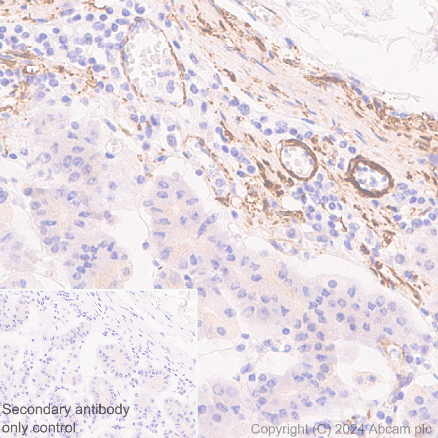 Immunohistochemistry (Formalin/PFA-fixed paraffin-embedded sections) - Anti-TAGLN/Transgelin antibody [EPR11995(B)] - BSA and Azide free (ab249579), expandable thumbnail