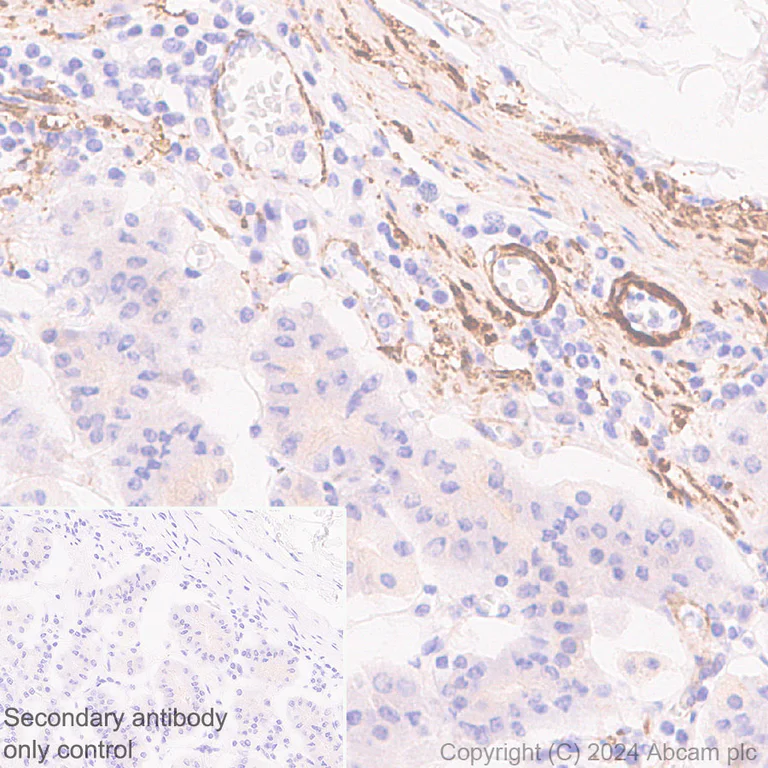 Immunohistochemistry (Formalin/PFA-fixed paraffin-embedded sections) - Anti-TAGLN/Transgelin antibody [EPR11995(B)] - BSA and Azide free (AB249579)