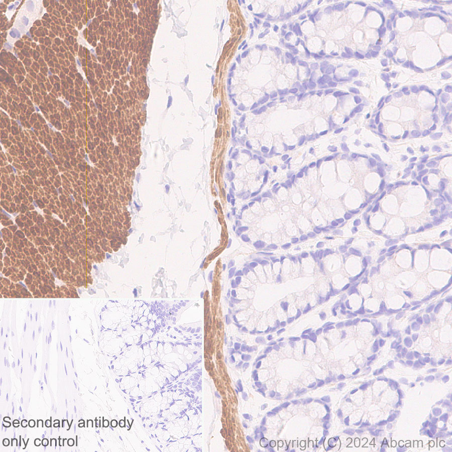 Immunohistochemistry (Formalin/PFA-fixed paraffin-embedded sections) - Anti-TAGLN/Transgelin antibody [EPR11995(B)] - BSA and Azide free (ab249579), expandable thumbnail