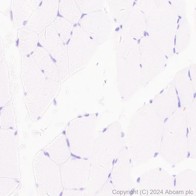 Immunohistochemistry (Formalin/PFA-fixed paraffin-embedded sections) - Anti-TAGLN/Transgelin antibody [EPR11995(B)] - BSA and Azide free (AB249579)