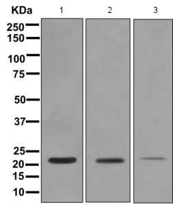 Western blot - Anti-TAGLN/Transgelin antibody [EPR11995(B)] - BSA and Azide free (AB249579), expandable thumbnail