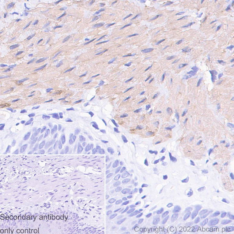 Immunohistochemistry (Formalin/PFA-fixed paraffin-embedded sections) - Anti-TAGLN/Transgelin antibody [EPR21206] (AB213273)