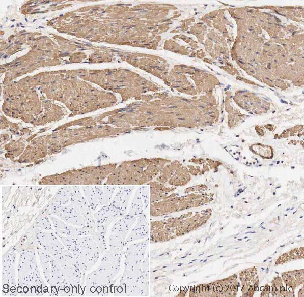 Immunohistochemistry (Formalin/PFA-fixed paraffin-embedded sections) - Anti-TAGLN/Transgelin antibody [EPR21206] - BSA and Azide free (AB326578)