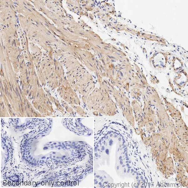 Immunohistochemistry (Formalin/PFA-fixed paraffin-embedded sections) - Anti-TAGLN/Transgelin antibody [EPR21206] - BSA and Azide free (AB326578)