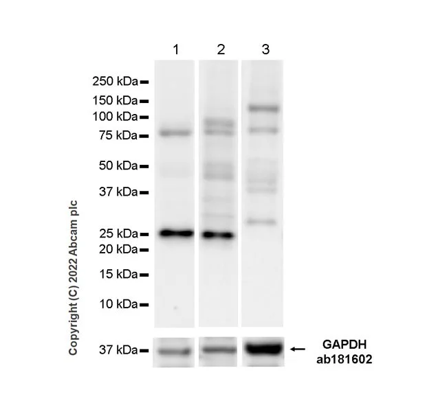 Western blot - Anti-TAGLN/Transgelin antibody [EPR21206] - BSA and Azide free (AB326578)