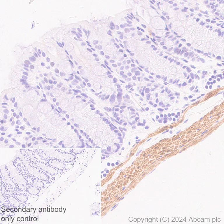 Immunohistochemistry (Formalin/PFA-fixed paraffin-embedded sections) - Anti-TAGLN/Transgelin antibody [EPR21215] (AB227566)