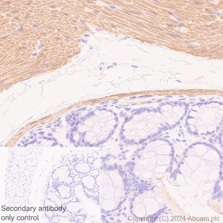 Immunohistochemistry (Formalin/PFA-fixed paraffin-embedded sections) - Anti-TAGLN/Transgelin antibody [EPR21215] (AB227566)