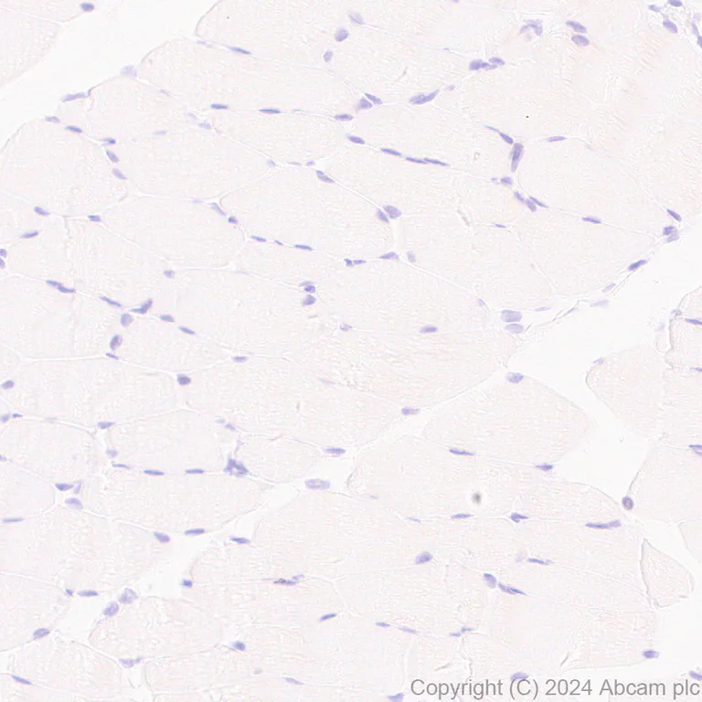 Immunohistochemistry (Formalin/PFA-fixed paraffin-embedded sections) - Anti-TAGLN/Transgelin antibody [EPR21215] (AB227566)