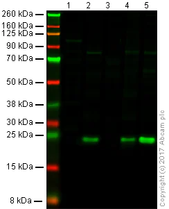 Western blot - Anti-TAGLN/Transgelin antibody [EPR21215] (AB227566)