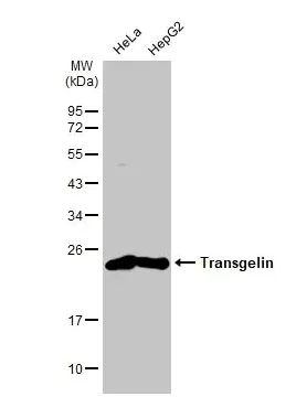 Western blot - Anti-TAGLN/Transgelin antibody [HL1270] - BSA and Azide free (AB313841)