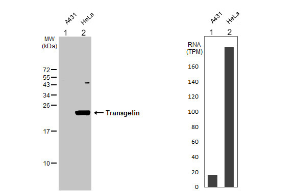 Western blot - Anti-TAGLN/Transgelin antibody [HL1270] - BSA and Azide free (AB313841), expandable thumbnail