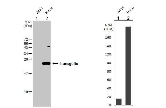 Western blot - Anti-TAGLN/Transgelin antibody [HL1270] - BSA and Azide free (AB313841)