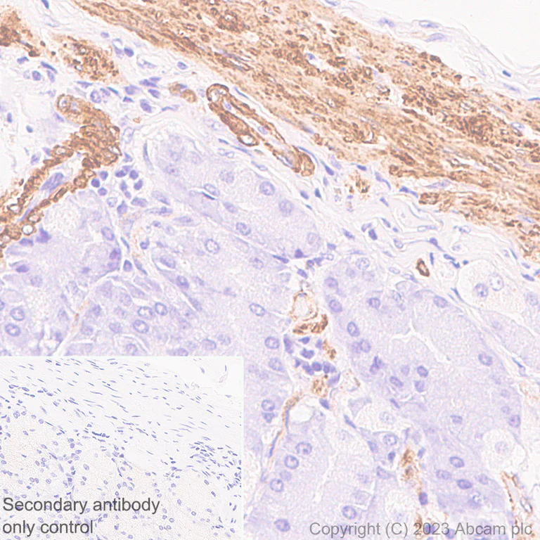 Immunohistochemistry (Formalin/PFA-fixed paraffin-embedded sections) - Anti-TAGLN/Transgelin antibody [RM1076] - BSA and Azide free (AB316021)