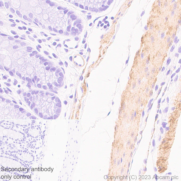 Immunohistochemistry (Formalin/PFA-fixed paraffin-embedded sections) - Anti-TAGLN/Transgelin antibody [RM1076] - BSA and Azide free (AB316021)