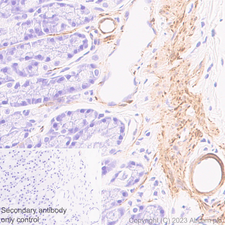 Immunohistochemistry (Formalin/PFA-fixed paraffin-embedded sections) - Anti-TAGLN/Transgelin antibody [RM1076] - BSA and Azide free (AB316021)