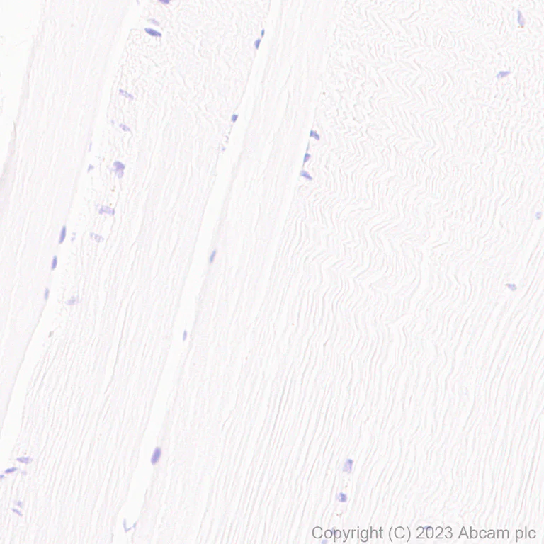 Immunohistochemistry (Formalin/PFA-fixed paraffin-embedded sections) - Anti-TAGLN/Transgelin antibody [RM1076] - BSA and Azide free (AB316021)