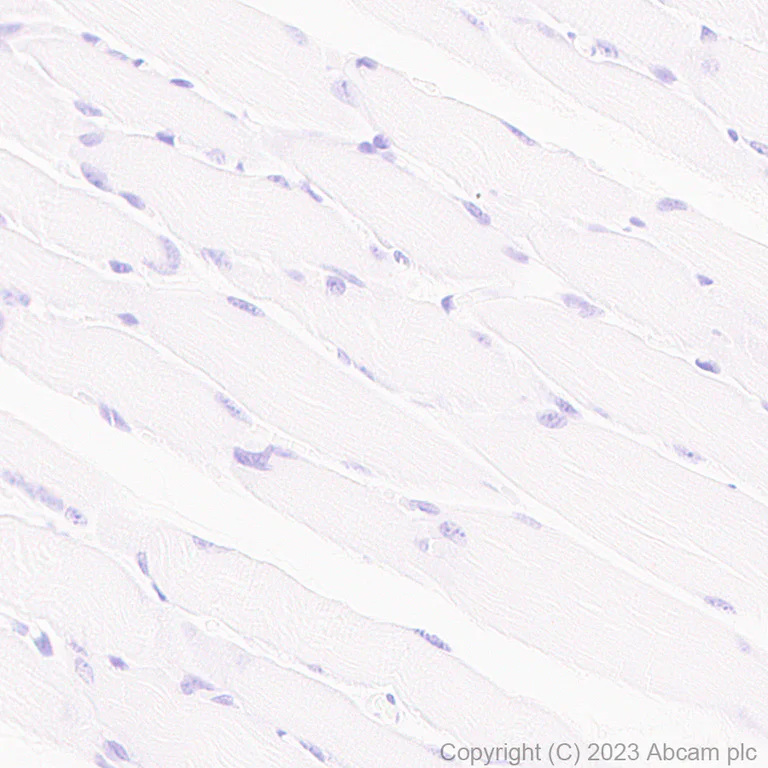 Immunohistochemistry (Formalin/PFA-fixed paraffin-embedded sections) - Anti-TAGLN/Transgelin antibody [RM1076] - BSA and Azide free (AB316021)