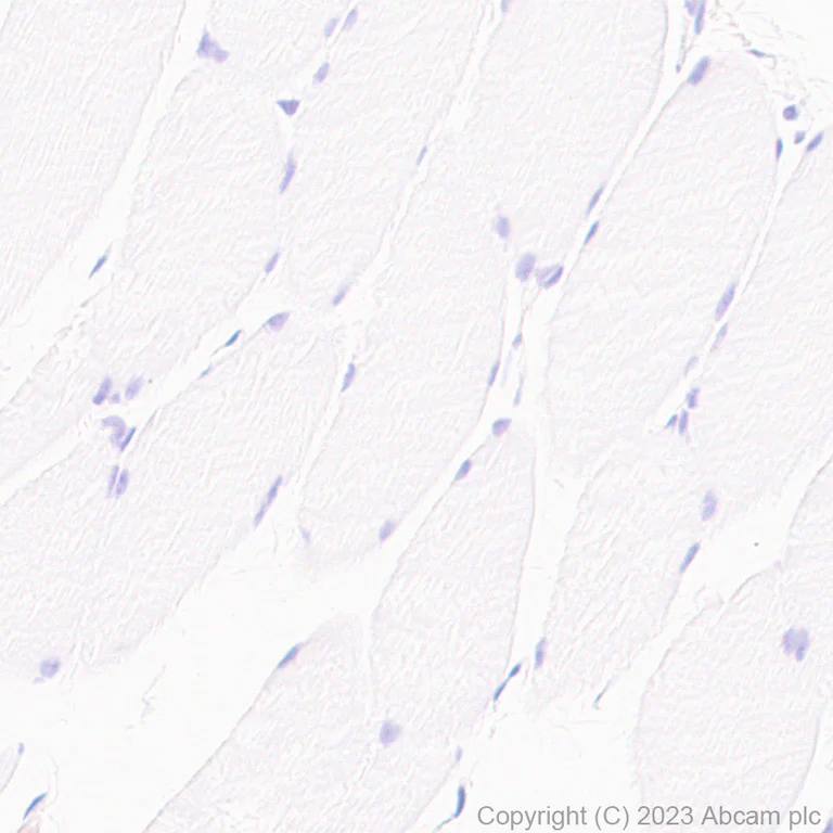 Immunohistochemistry (Formalin/PFA-fixed paraffin-embedded sections) - Anti-TAGLN/Transgelin antibody [RM1076] - BSA and Azide free (AB316021)