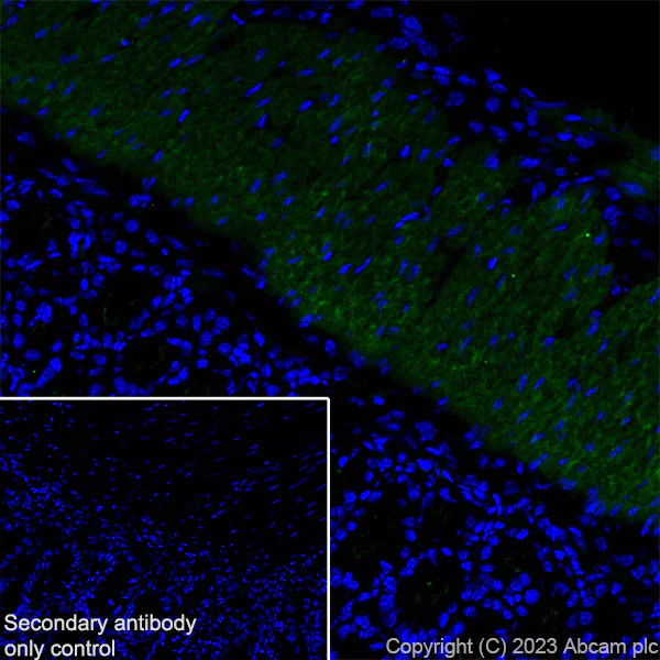 Immunohistochemistry (Frozen sections) - Anti-TAGLN/Transgelin antibody [RM1076] - BSA and Azide free (AB316021)