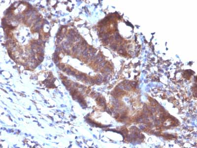 Immunohistochemistry (Formalin/PFA-fixed paraffin-embedded sections) - Anti-TAGLN/Transgelin antibody [TAGLN/247] (AB233971), expandable thumbnail