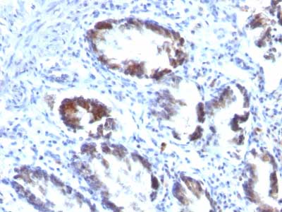 Immunohistochemistry (Formalin/PFA-fixed paraffin-embedded sections) - Anti-TAGLN/Transgelin antibody [TAGLN/247] (AB233971), expandable thumbnail