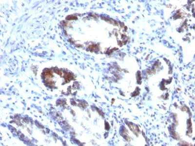 Immunohistochemistry (Formalin/PFA-fixed paraffin-embedded sections) - Anti-TAGLN/Transgelin antibody [TAGLN/247] (AB233971)