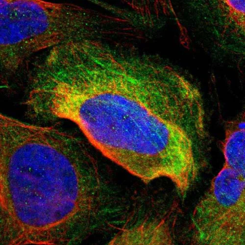 Immunocytochemistry/ Immunofluorescence - Anti-TAGLN2 antibody (AB121146)