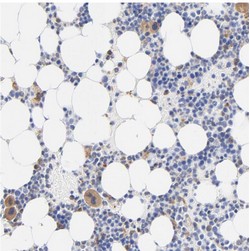Immunohistochemistry (Formalin/PFA-fixed paraffin-embedded sections) - Anti-TAGLN2 antibody (AB121146)