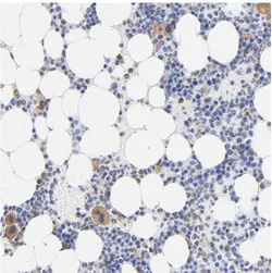 Immunohistochemistry (Formalin/PFA-fixed paraffin-embedded sections) - Anti-TAGLN2 antibody (AB121146)