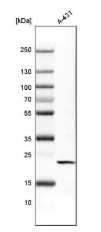Western blot - Anti-TAGLN2 antibody (AB121146)