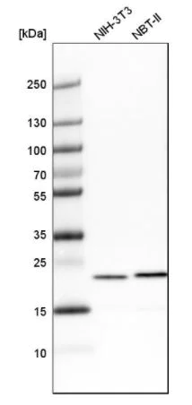 Western blot - Anti-TAGLN2 antibody (AB121146)
