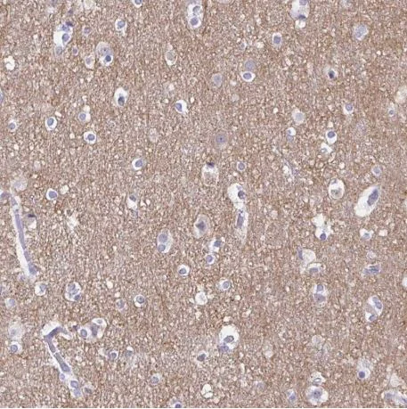 Immunohistochemistry (Formalin/PFA-fixed paraffin-embedded sections) - Anti-TAGLN3 antibody (AB204902)