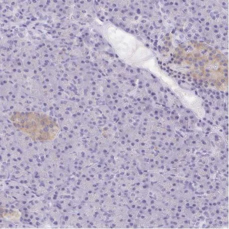 Immunohistochemistry (Formalin/PFA-fixed paraffin-embedded sections) - Anti-TAGLN3 antibody (AB204902)