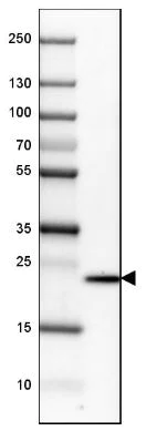 Western blot - Anti-TAGLN3 antibody (AB204902)