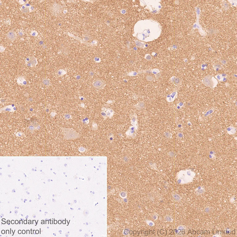 Immunohistochemistry (Formalin/PFA-fixed paraffin-embedded sections) - Anti-TAGLN3 antibody [EPR31032-506] (AB326940)
