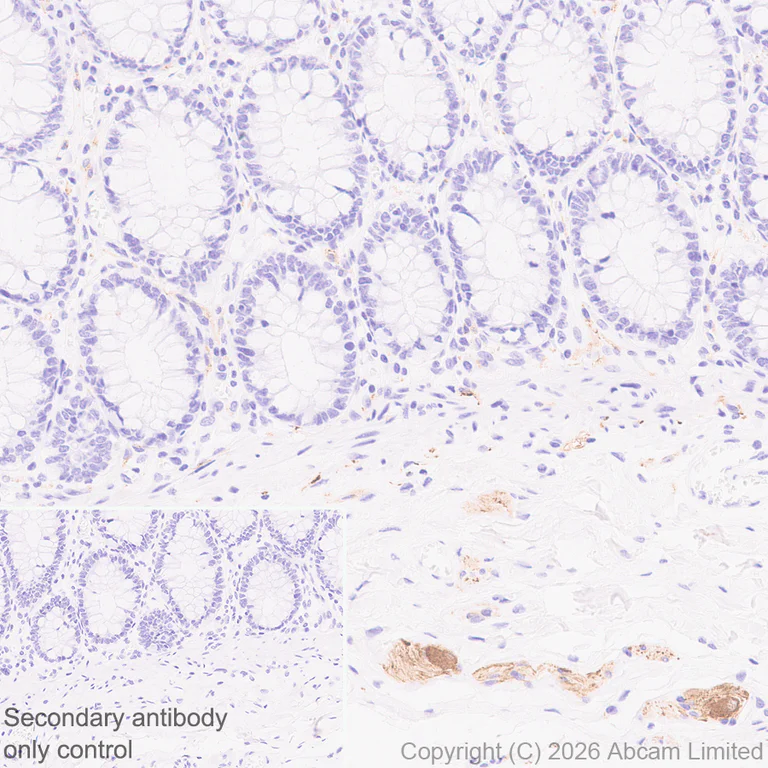 Immunohistochemistry (Formalin/PFA-fixed paraffin-embedded sections) - Anti-TAGLN3 antibody [EPR31032-506] (AB326940)