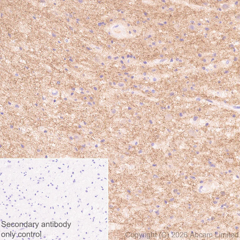 Immunohistochemistry (Formalin/PFA-fixed paraffin-embedded sections) - Anti-TAGLN3 antibody [EPR31032-506] (AB326940)