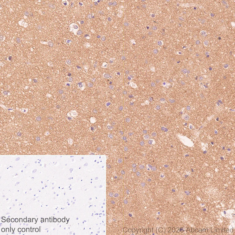 Immunohistochemistry (Formalin/PFA-fixed paraffin-embedded sections) - Anti-TAGLN3 antibody [EPR31032-506] (AB326940)