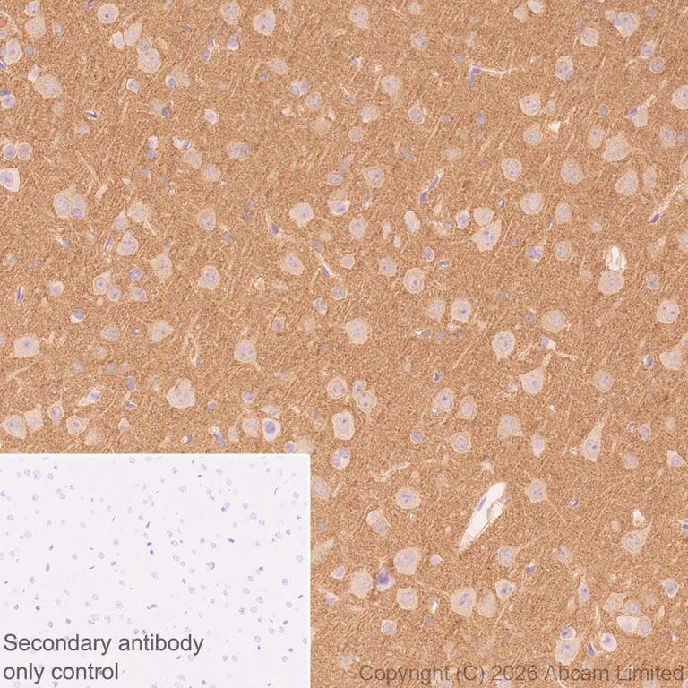 Immunohistochemistry (Formalin/PFA-fixed paraffin-embedded sections) - Anti-TAGLN3 antibody [EPR31032-506] (AB326940)