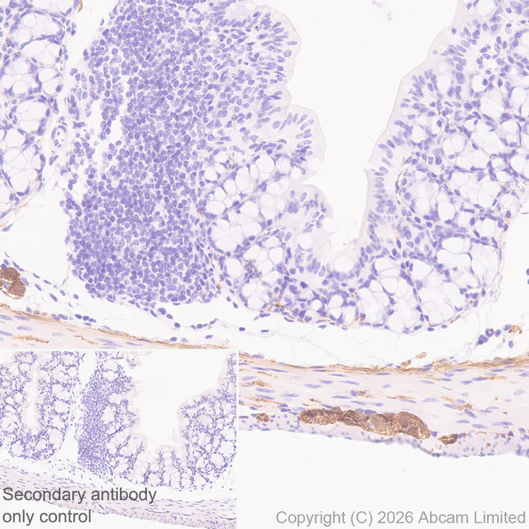 Immunohistochemistry (Formalin/PFA-fixed paraffin-embedded sections) - Anti-TAGLN3 antibody [EPR31032-506] (AB326940)