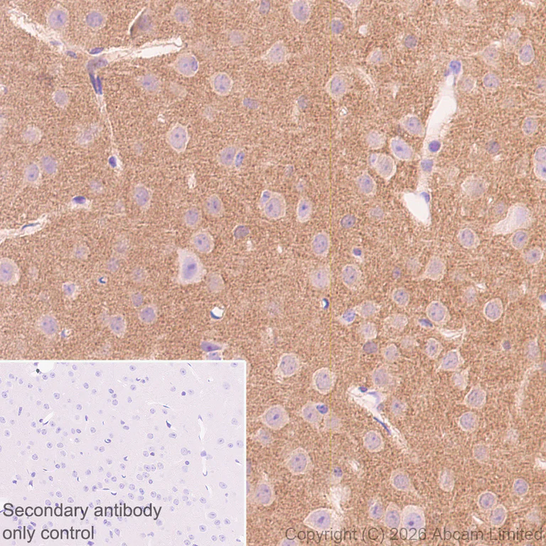 Immunohistochemistry (Formalin/PFA-fixed paraffin-embedded sections) - Anti-TAGLN3 antibody [EPR31032-506] (AB326940)