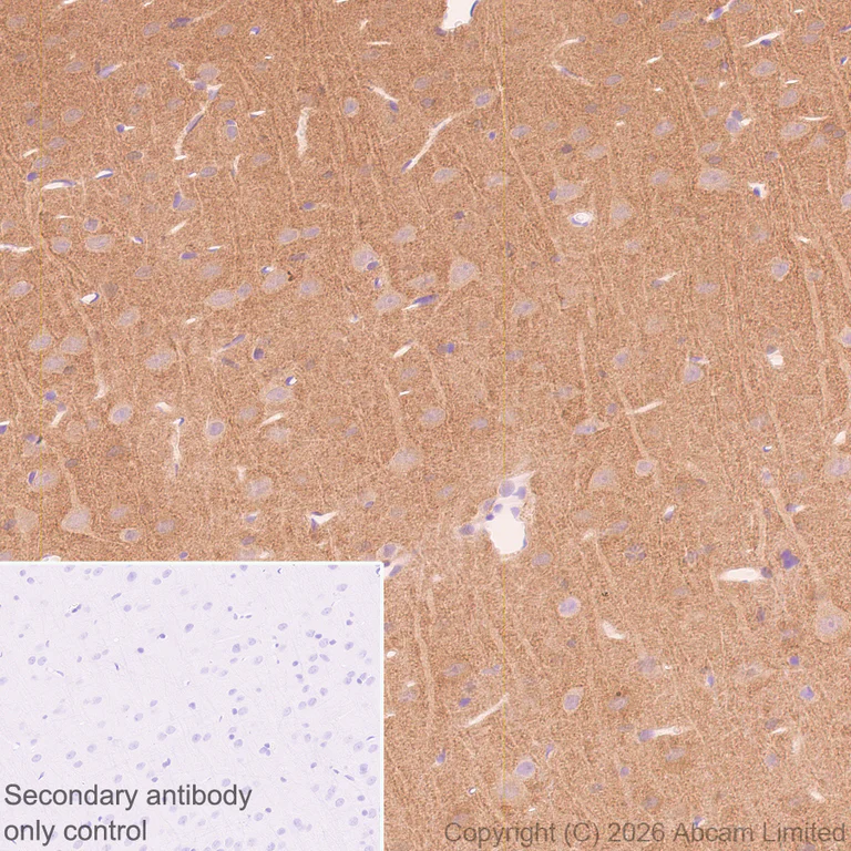 Immunohistochemistry (Formalin/PFA-fixed paraffin-embedded sections) - Anti-TAGLN3 antibody [EPR31032-506] (AB326940)