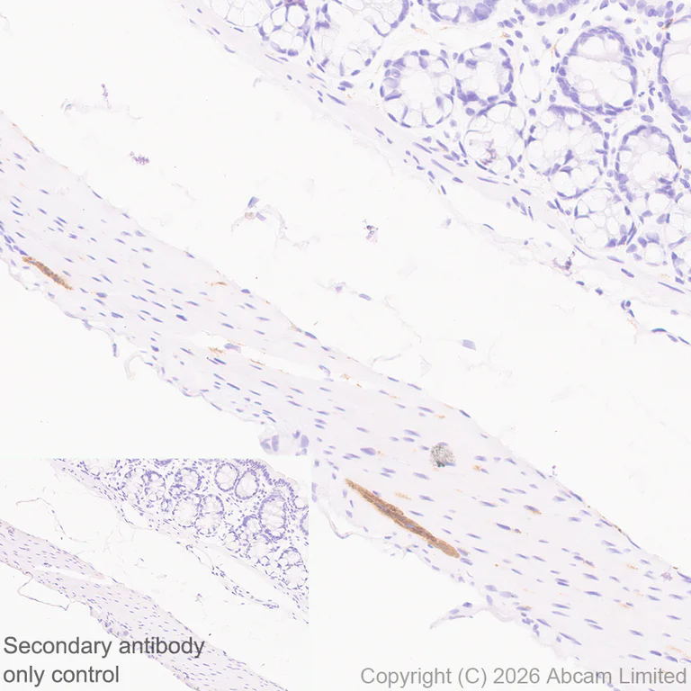 Immunohistochemistry (Formalin/PFA-fixed paraffin-embedded sections) - Anti-TAGLN3 antibody [EPR31032-506] (AB326940)