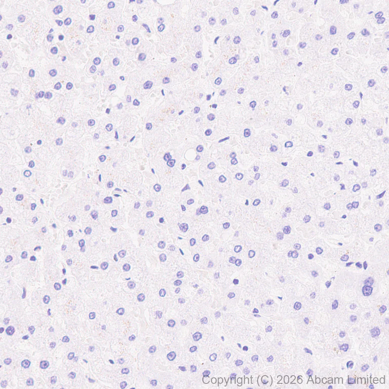 Immunohistochemistry (Formalin/PFA-fixed paraffin-embedded sections) - Anti-TAGLN3 antibody [EPR31032-506] (AB326940)