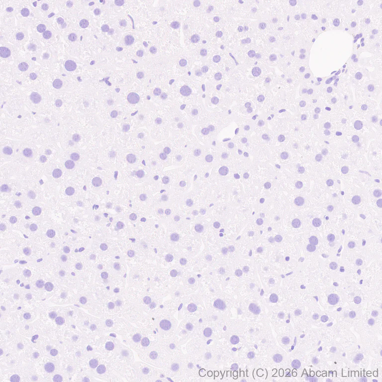 Immunohistochemistry (Formalin/PFA-fixed paraffin-embedded sections) - Anti-TAGLN3 antibody [EPR31032-506] (AB326940)