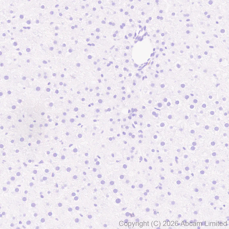 Immunohistochemistry (Formalin/PFA-fixed paraffin-embedded sections) - Anti-TAGLN3 antibody [EPR31032-506] (AB326940)