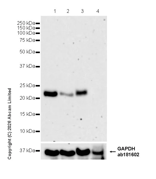 Western blot - Anti-TAGLN3 antibody [EPR31032-506] (AB326940)