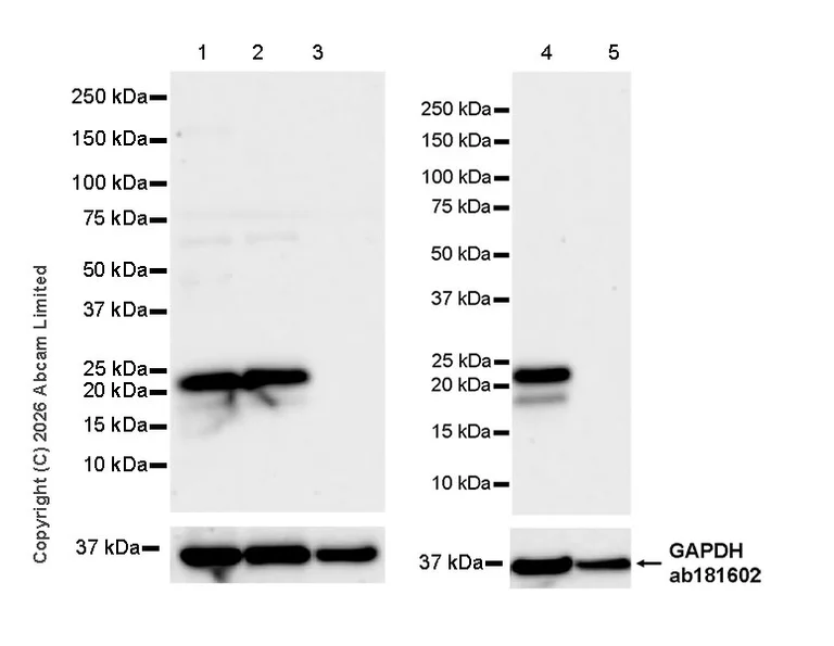 Western blot - Anti-TAGLN3 antibody [EPR31032-506] (AB326940)